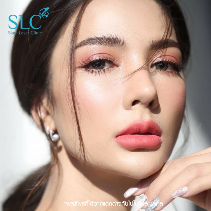 รวมรีวิวฉีดฟิลเลอร์ปากสายฝอ ก่อน หลังฉีด หน้าเปลี่ยนขนาดไหน Articles Slc Clinic คลินิกเสริม